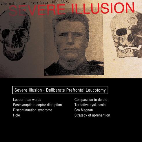 19/03/2014 : SEVERE ILLUSION - Deliberate Prefrontal Leucotomy